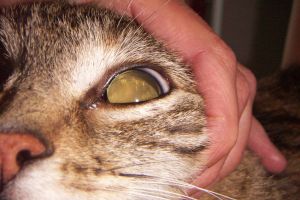 Linsenluxation anterior, die Linse sitzt vor der Pupille anstatt dahinter